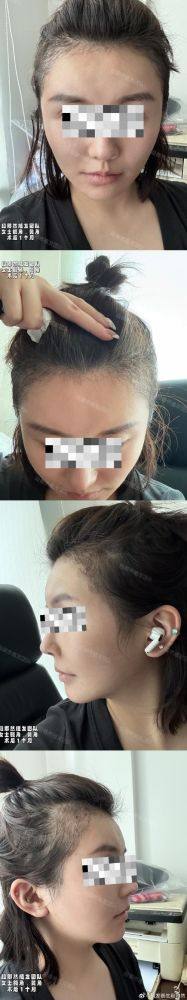 韩国狎鸥亭延世整形外科 