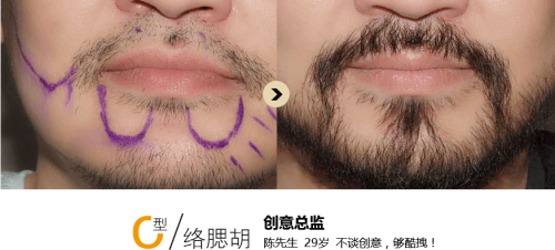 韩国狎鸥亭延世整形外科 