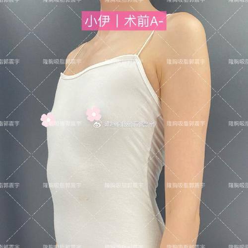 北京美度医疗美容中 心擅长项目