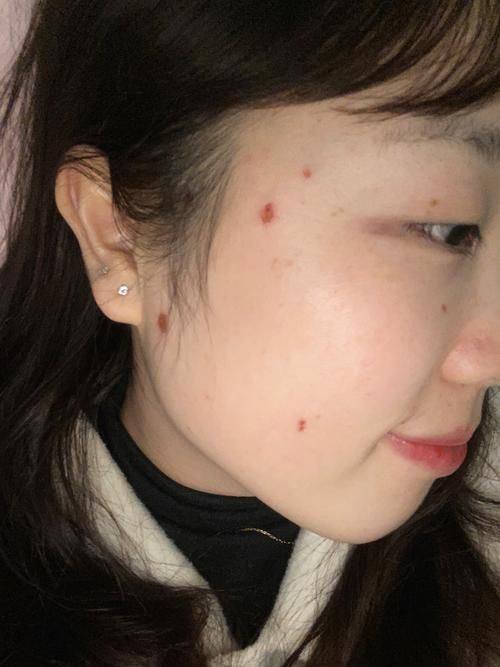 北京聚星汇整形医院口碑评价