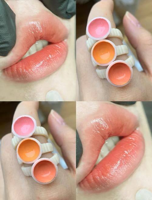 广州慕兰医疗美容门诊部地址电话及营业时间：