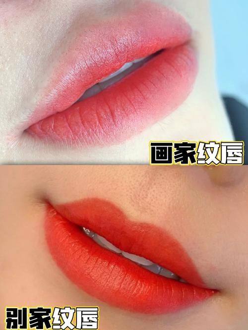 广州慕兰医疗美容门诊部怎么样？