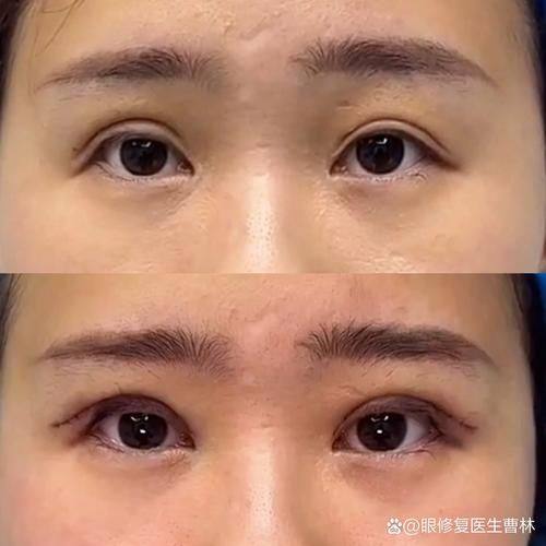 广州慕兰医疗美容门诊部擅长项目：