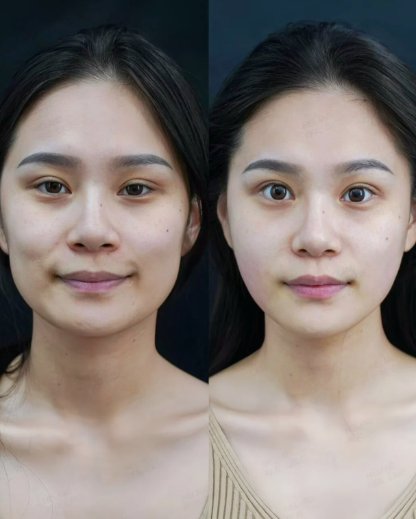 个旧市第一人民医院整形美容科怎么样