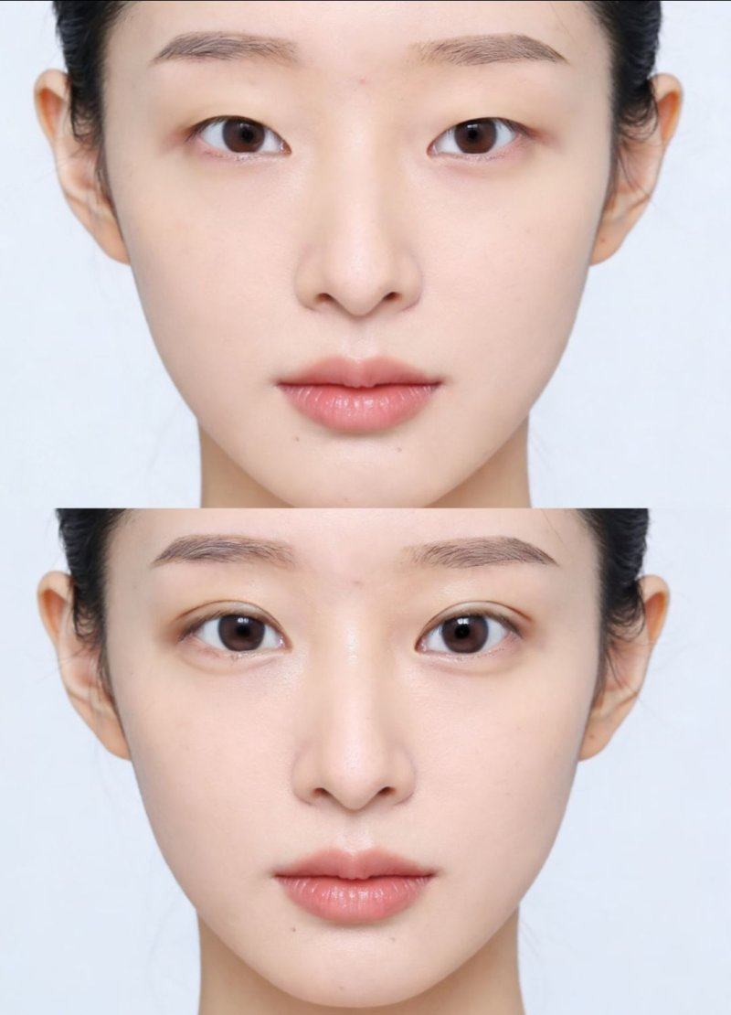 徐州美特莱斯医疗美容医院口碑评价：