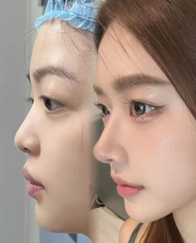 个旧市第一人民医院整形美容科预约挂号方式