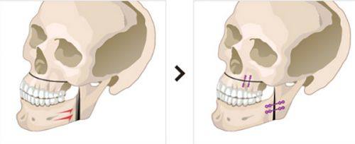 郑州名门医疗美容整形医院口碑评价：