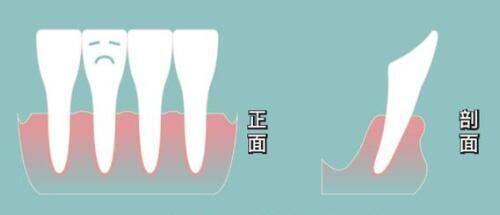 三、用鸡蛋敷眼睛为什么能缓解暂时性眼袋?