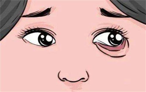 四、鸡蛋敷眼的正确操作与常见误区