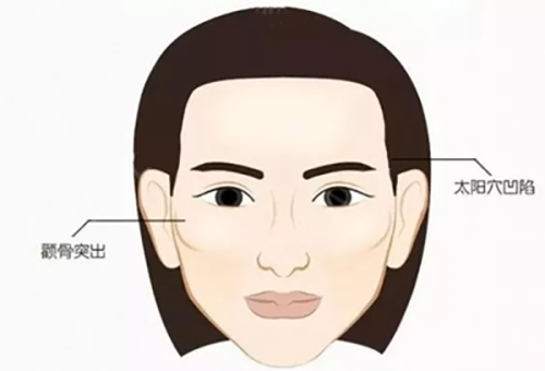 二、怎么消除黑眼圈眼袋日常方法:从生活习惯入手根源改善