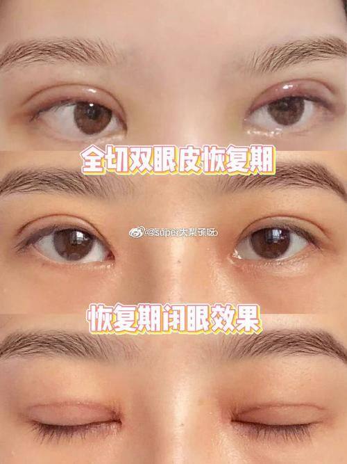 北京一美整形医疗美容诊所怎么样？