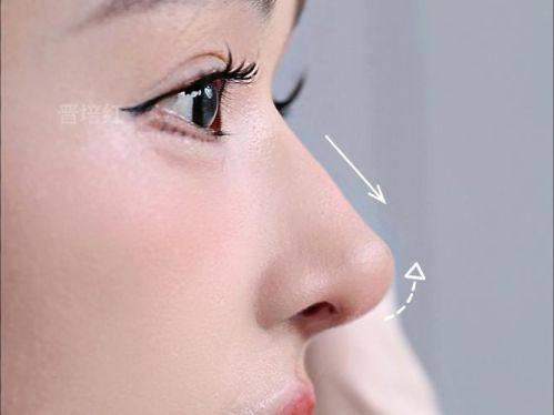 西安美人鱼医疗管理有限公司高新医疗美容门诊部怎么样？