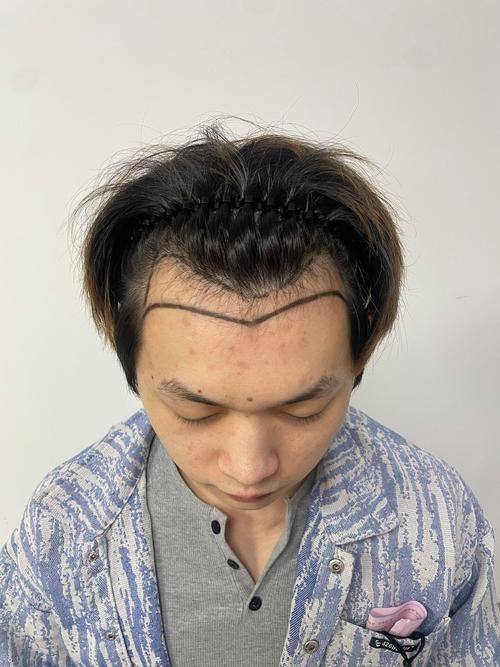 成都丝缘植发医疗美容门诊部地址电话及营业时间