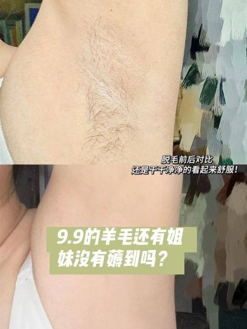 成都高新安轻美整形医院价格表：