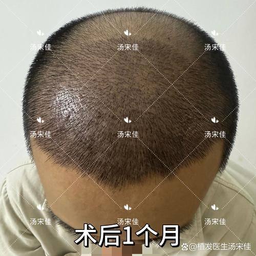 成都丝缘植发医疗美容门诊部怎么样？