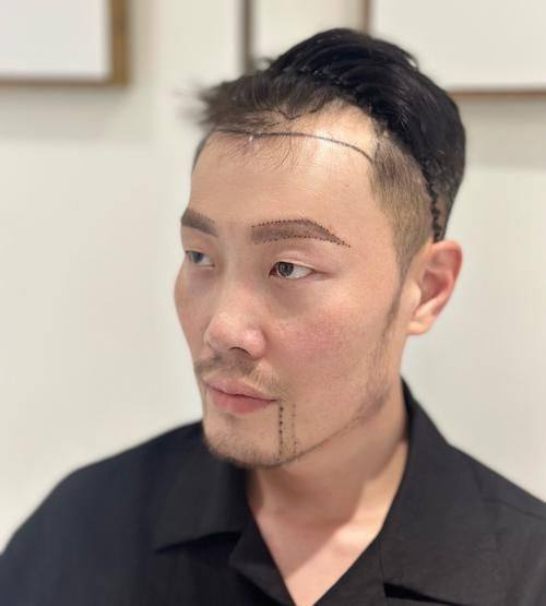 成都丝缘植发医疗美容门诊部擅长项目：