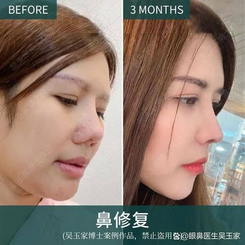 株洲市艺佳医疗美容专科医院怎么样？