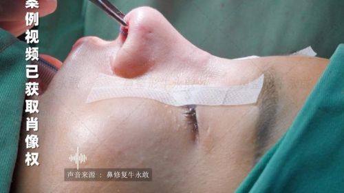 西安美人鱼医疗管理有限公司高新医疗美容门诊部预约挂号方式：