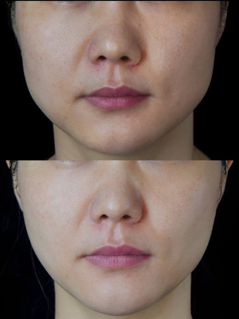 五、治疗次数与费用参考