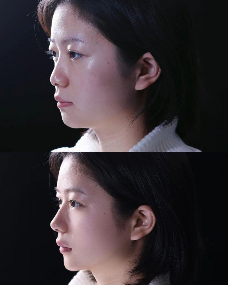 四、科学护理助力疤痕修复正常状态