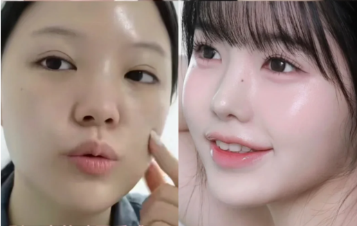 四、黑色疤痕治疗的价格参考