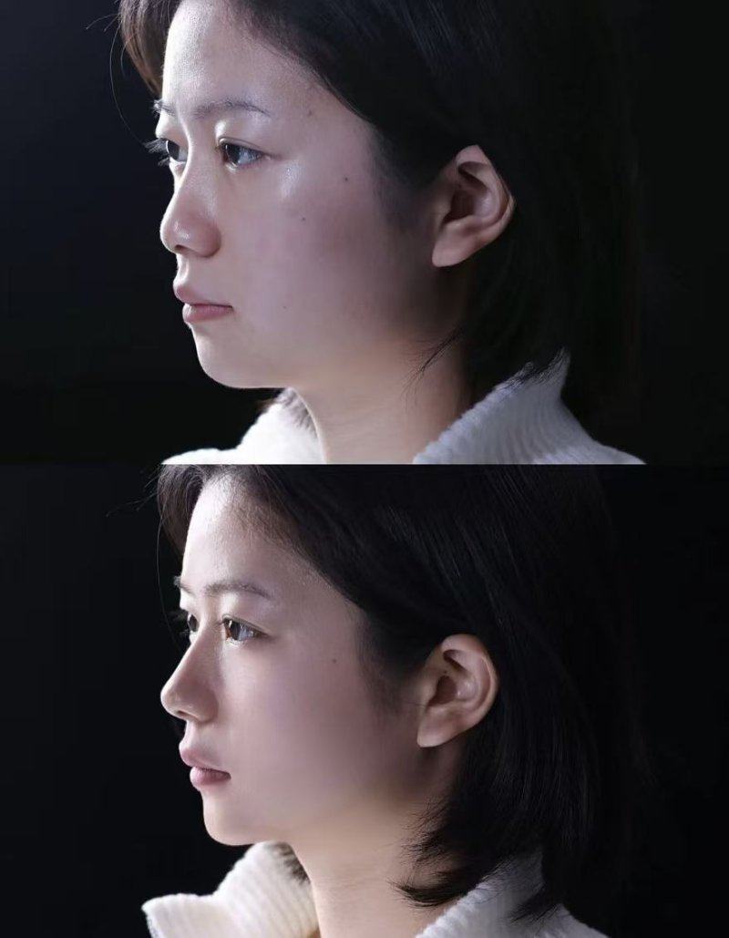 成都高新安轻美整形医院怎么样？