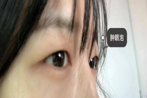 南京恒丽整形医院预约挂号方式：