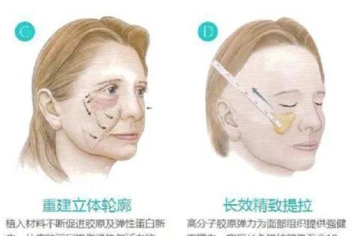 二、别再被网传芹菜叶去眼袋方法误导