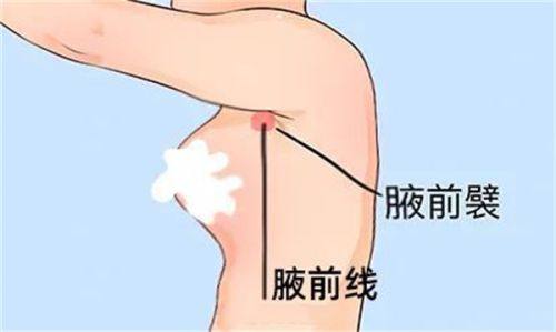 五、日常辅助护理，帮你缓解或预防眼袋