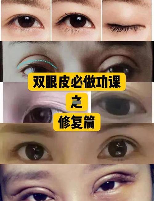 青岛北博士整形美容医院擅长项目：