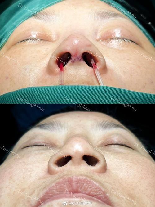 泉州石狮柏丽整形美容医院地址电话及营业时间：