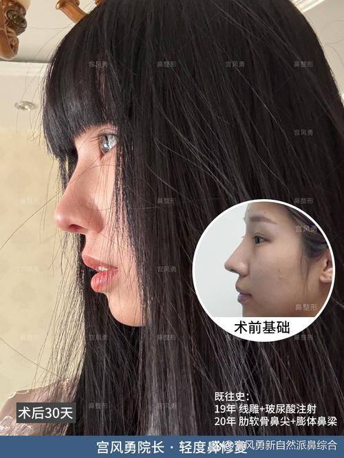 烟台莱阳悦美人整形医院口碑评价: