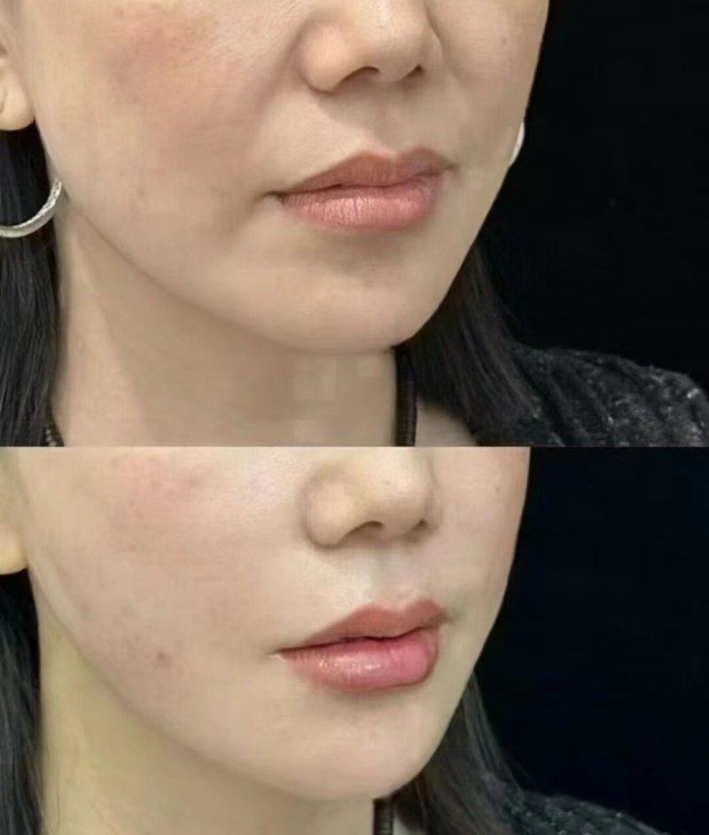 五、影响疤痕内膜修复与妊娠的关键因素