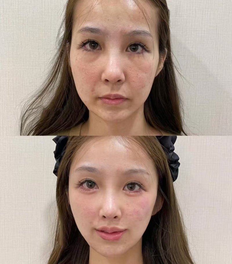 泉州石狮柏丽整形美容医院预约挂号方式：