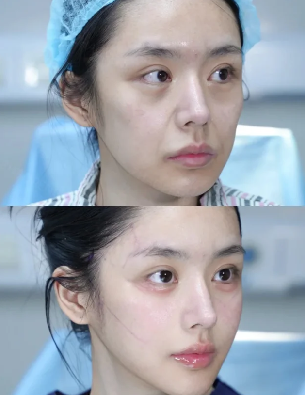 四、疤痕体质人群的专属管理方案