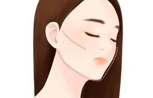 四、理性看待双眼皮手术：从自身需求出发，拒绝焦虑与迷信