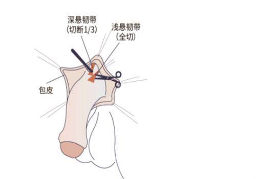 五、去眼袋手术机构选择的核心参考要点