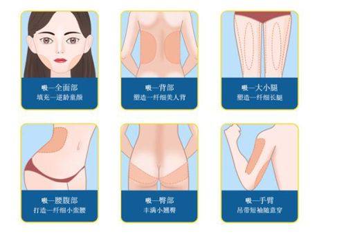 二、20/25/30cm怎么选?看完空间条件不纠结