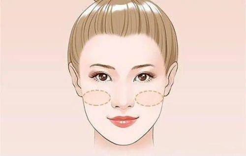 四、针对性抗疤干预，精细淡化早期缝线疤痕