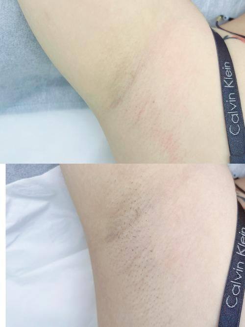 上海长征医院南京分院皮肤激光美容中 心预约挂号方式：