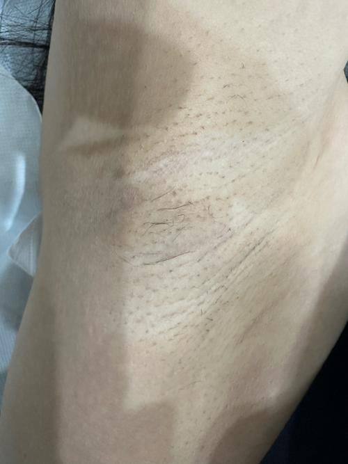 武汉茜韵整形医院价格表: