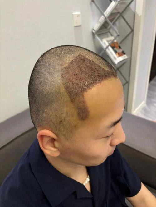 河南濮阳市张大夫整形口碑评价：