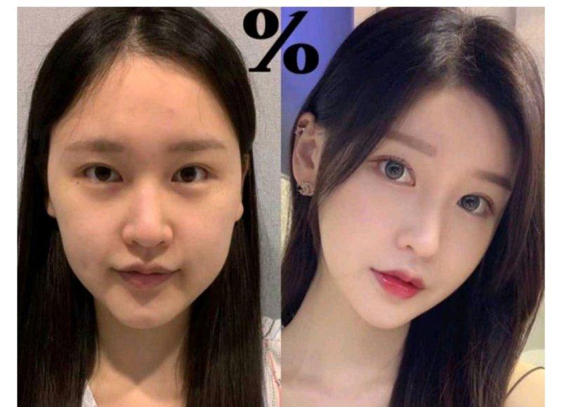 五、注射间隔的常见误区，你踩坑了吗？