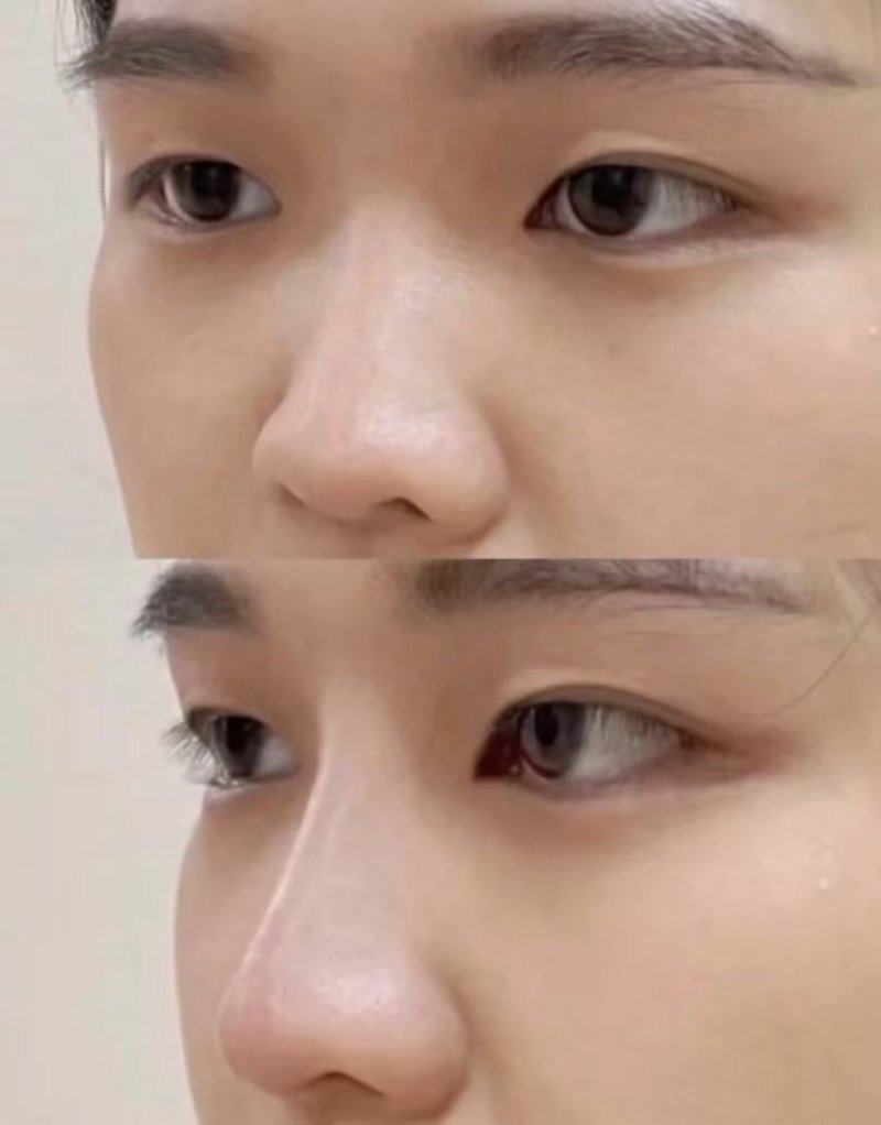 乌鲁木齐青春定格医疗美容门诊部价格表：