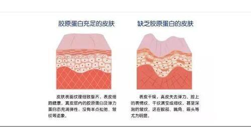 五、双眼皮疤痕增生多久消失&能去掉吗