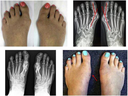 二、传统面相学中额头疤痕的宫位细分解读