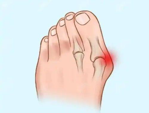 三、头发种植成效是否持久，能保持多久