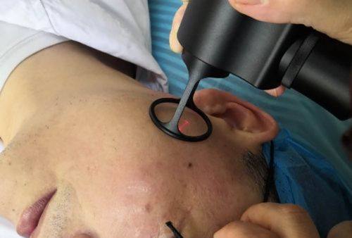 三、假体隆胸多少cc对应一个罩杯