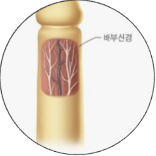 二、哪些因素在悄悄影响软耳骨隆鼻的维持时长