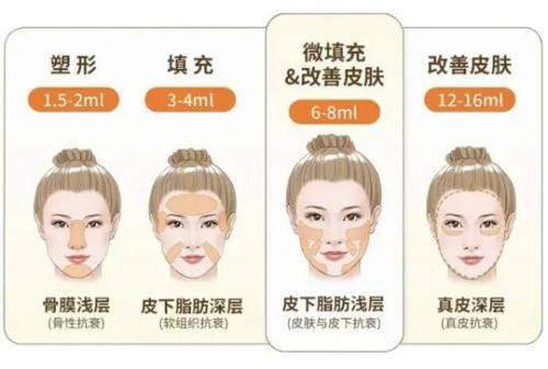 三、双眼皮眼角疤痕增生怎么办